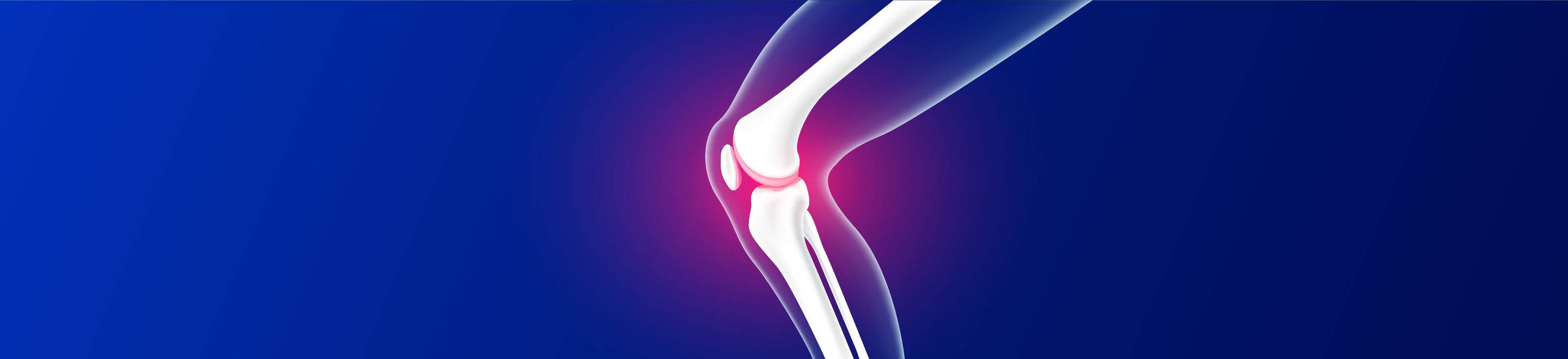 What is Osteoarthritis- Right Shift